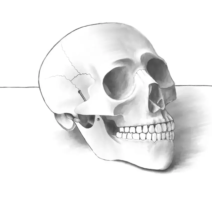 skull-drawing
